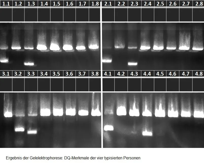 Das Ergebnis der Gelelektrophorese. Foto: DBS Lich